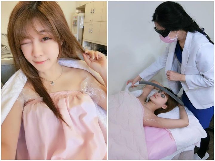【雷射除毛】雷射讓毛囊縮小～就會越長越少啦！